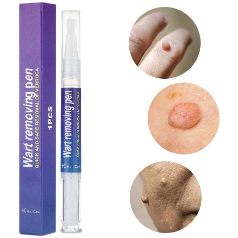 Wart Removing Pen